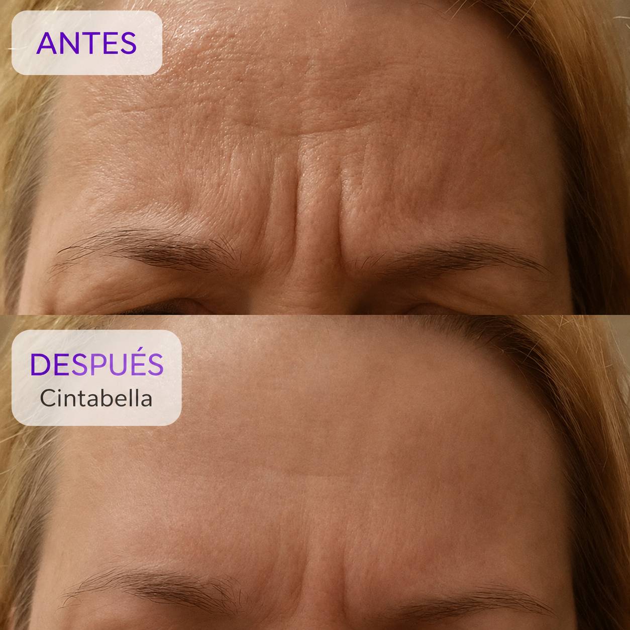 Antes y después usando Cintabella